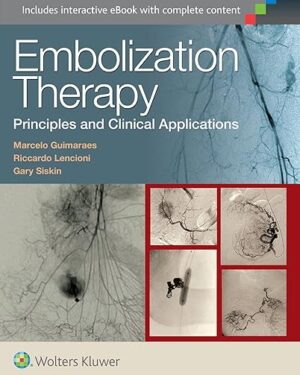 Embolization Therapy Principles and Clinical Applications First Edition