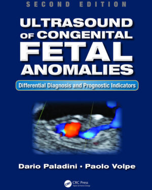 Ultrasound of Congenital Fetal Anomalies Differential Diagnosis and Prognostic Indicators, Second Edition