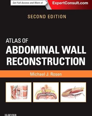 Atlas of Abdominal Wall Reconstruction Expert Consult 2nd Edition
