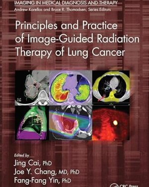 Principles and Practice of Image-Guided Radiation Therapy of Lung Cancer (Imaging in Medical Diagnosis and Therapy) 1st Edition