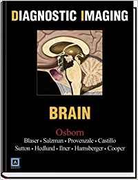 Diagnostic Imaging Brain 1st Edition