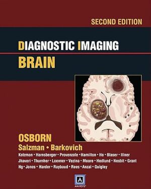 Diagnostic Imaging Brain 2nd Edition