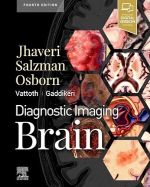 Diagnostic Imaging Brain E-Book 4th Edition