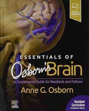 Essentials of Osborn's Brain A Fundamental Guide for Residents and Fellows 1st Edition