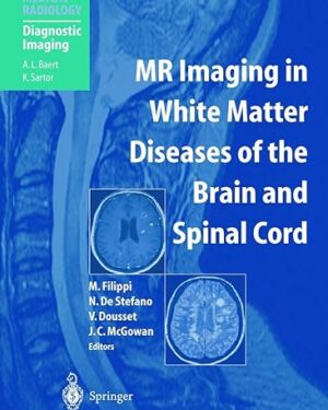 MR Imaging in White Matter Diseases of the Brain and Spinal Cord (Medical Radiology) 2005th Edition