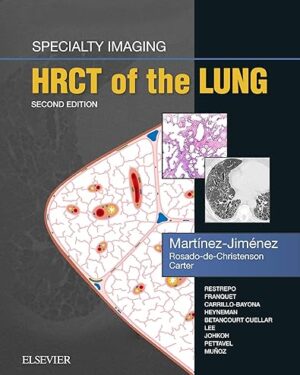 Specialty Imaging HRCT of the Lung E-Book 2nd Edition  PDF, eBook, Instant Download