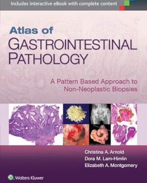Atlas of Gastrointestinal Pathology First Edition PDF eBook – Pattern Based Approach – Instant Download