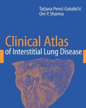 Clinical Atlas of Interstitial Lung Disease 2006th Edition PDF eBook Instant Download