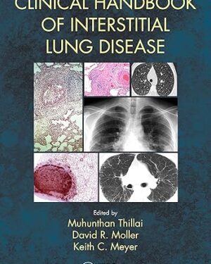 Clinical Handbook of Interstitial Lung Disease PDF eBook Instant Download